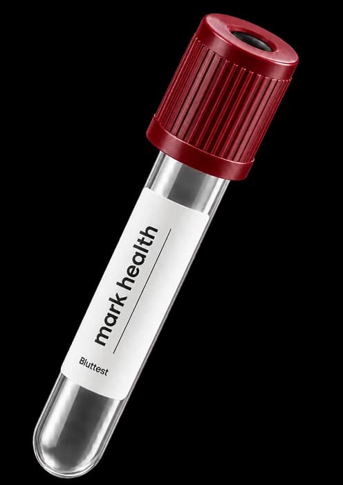 Blutentnahmeröhrchen von Mark Health